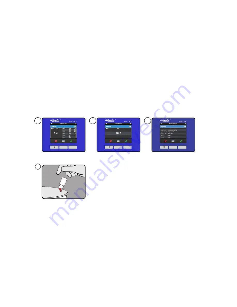 HemoCue WBC DIFF Operating Manual Download Page 46