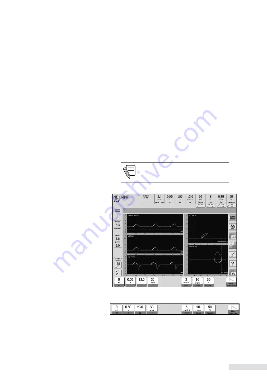 Heyer iTernIS ADV Operator'S Manual Download Page 123