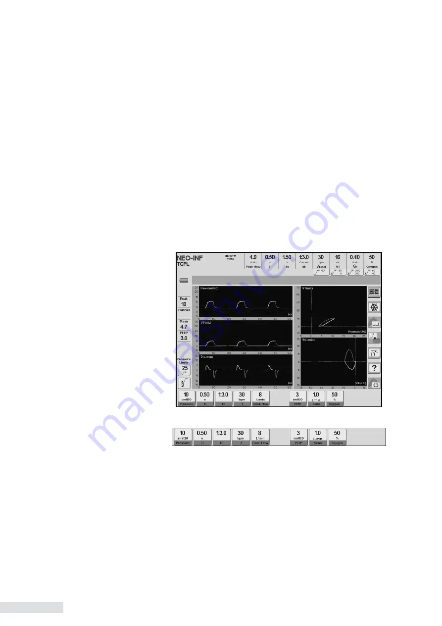 Heyer iTernIS ADV Operator'S Manual Download Page 130