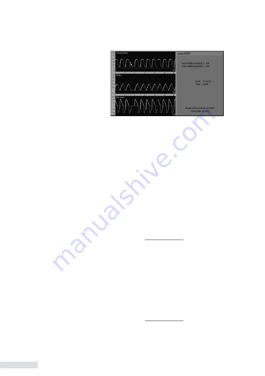 Heyer iTernIS ADV Operator'S Manual Download Page 152