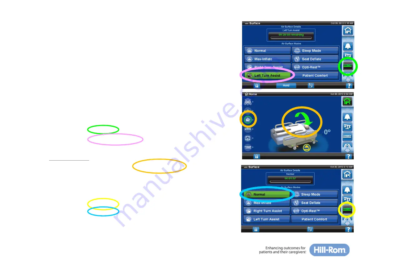 Hill-Rom The Progressa Quick Reference Manual Download Page 31