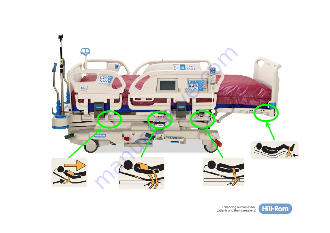 Hill-Rom The Progressa Quick Reference Manual Download Page 39