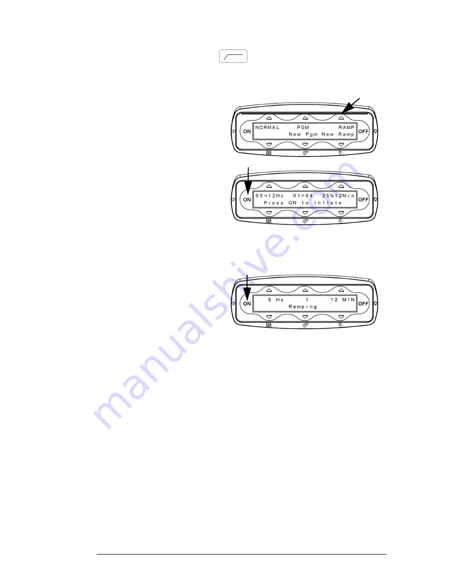 Hill-Rom The Vest P205 User Manual Download Page 29