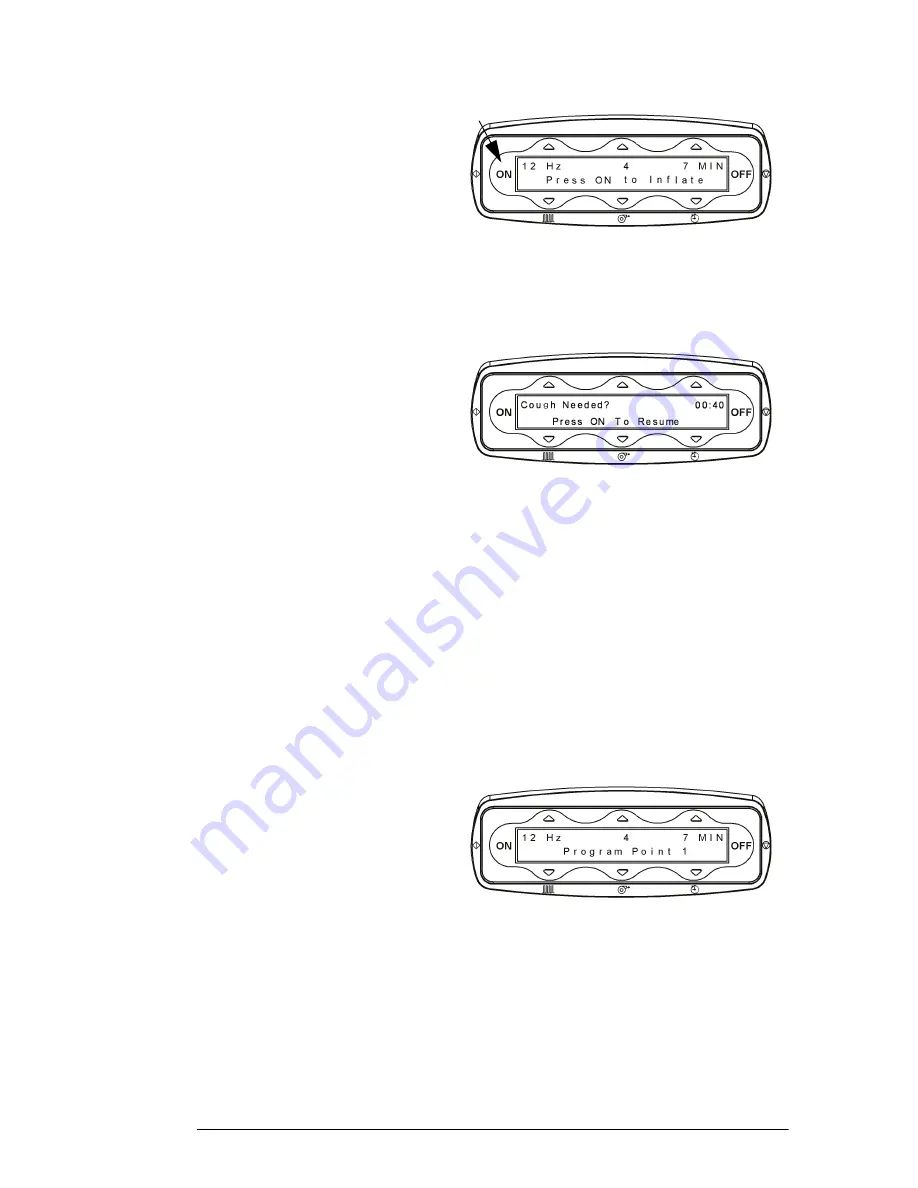 Hill-Rom The Vest P205 User Manual Download Page 41