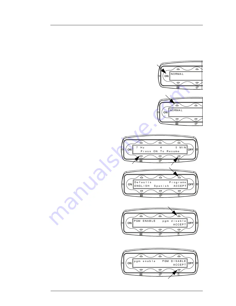 Hill-Rom The Vest P205 User Manual Download Page 53