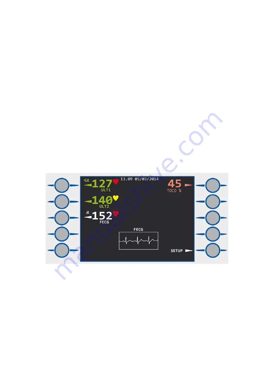 Huntleigh Sonicaid FM800 Series Instructions For Use Manual Download Page 47