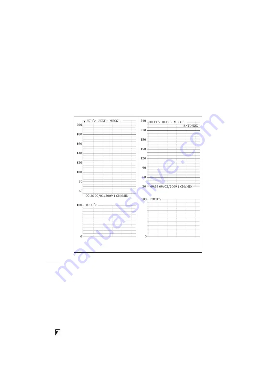 Huntleigh Sonicaid FM800 Series Instructions For Use Manual Download Page 84