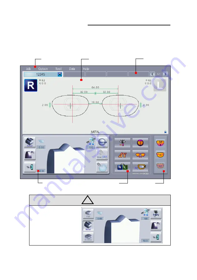 Huvitz Excelon XD Operator'S Manual Download Page 25