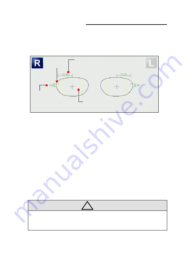 Huvitz Excelon XD Operator'S Manual Download Page 53