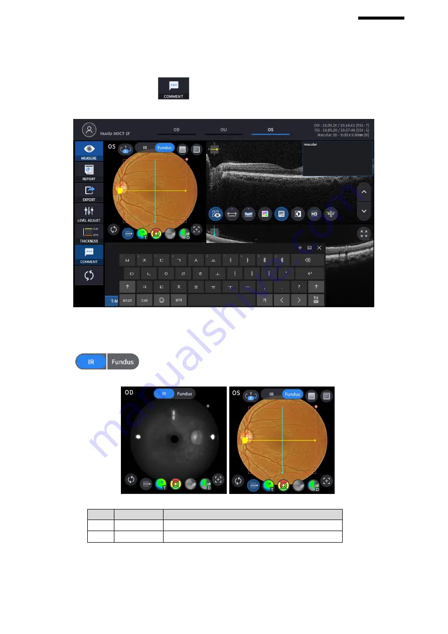 Huvitz HOCT-1 User Manual Download Page 67