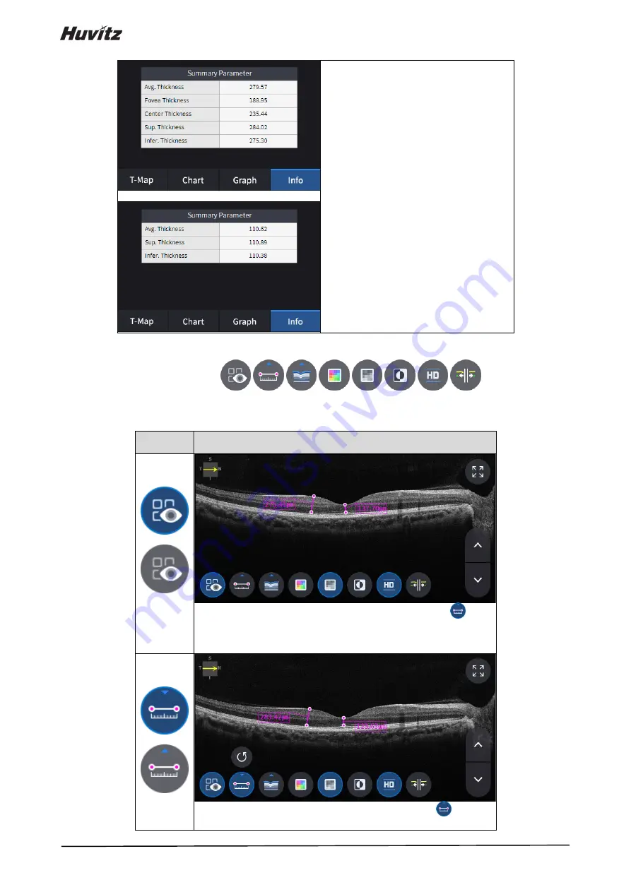 Huvitz HOCT-1 User Manual Download Page 70