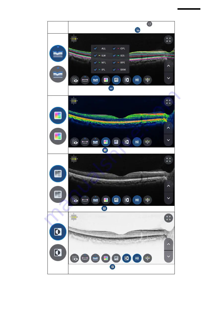 Huvitz HOCT-1 User Manual Download Page 71