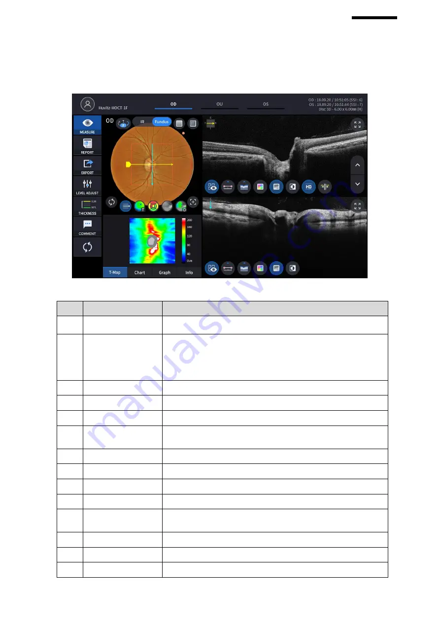 Huvitz HOCT-1 User Manual Download Page 73