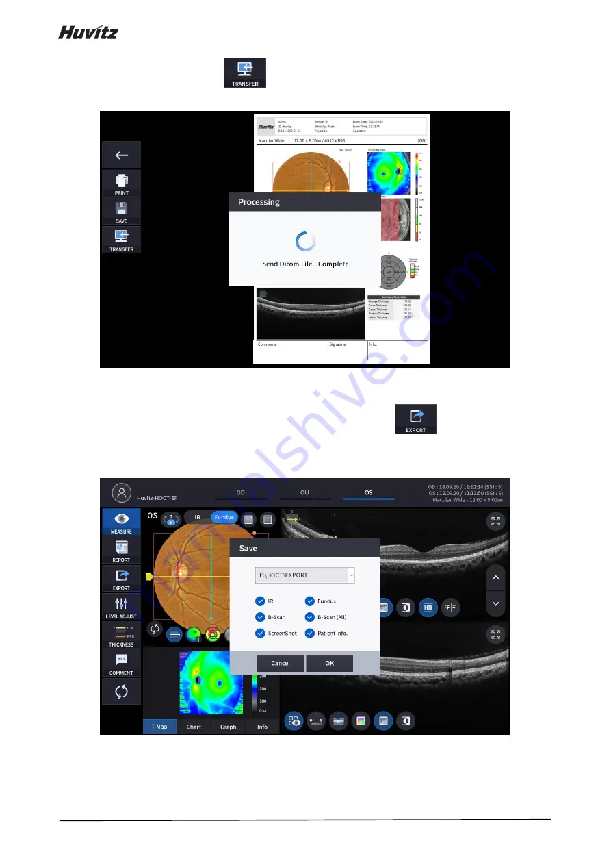 Huvitz HOCT-1 User Manual Download Page 90