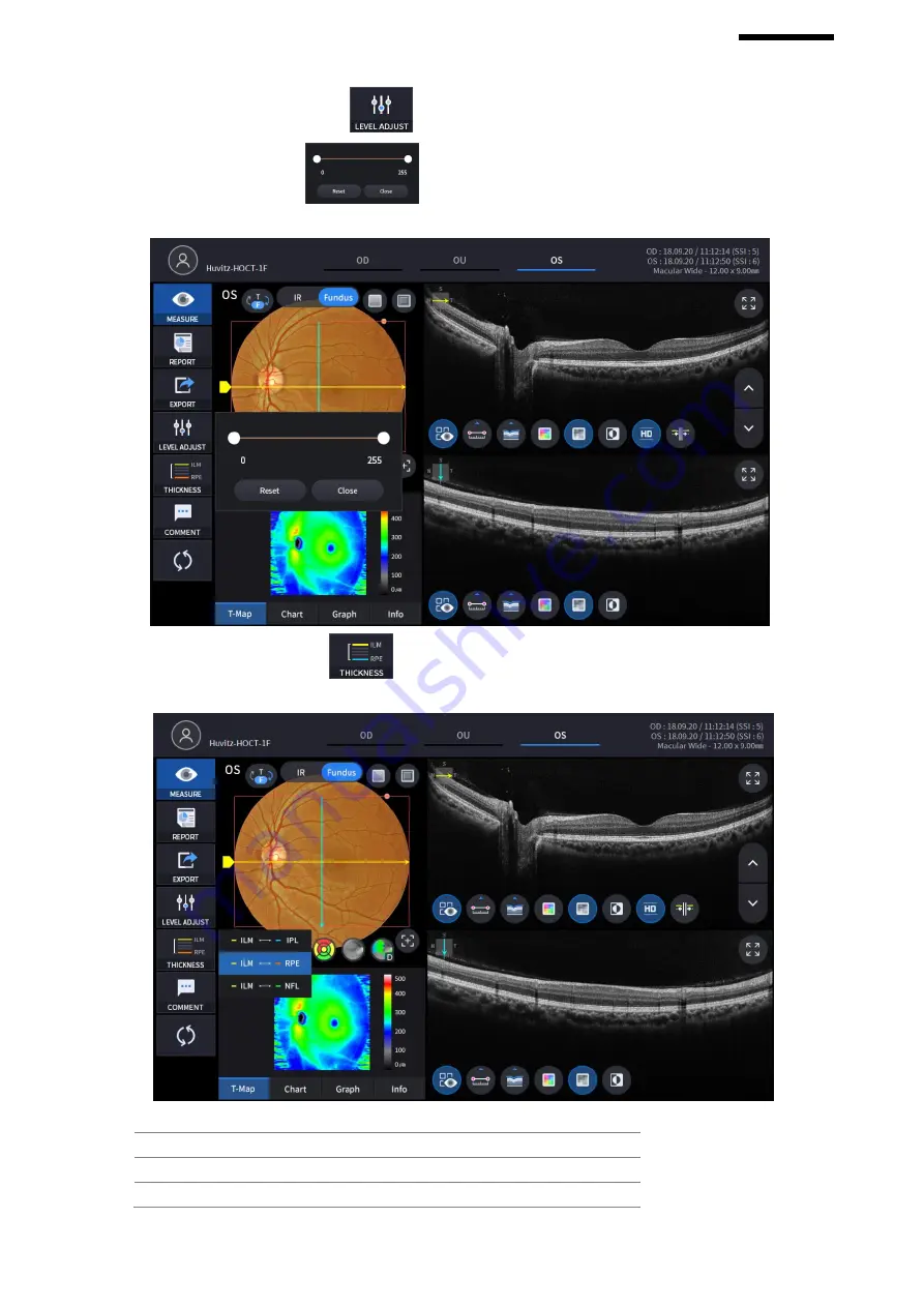 Huvitz HOCT-1 User Manual Download Page 91