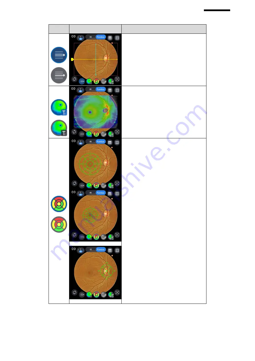 Huvitz HOCT-1 User Manual Download Page 93