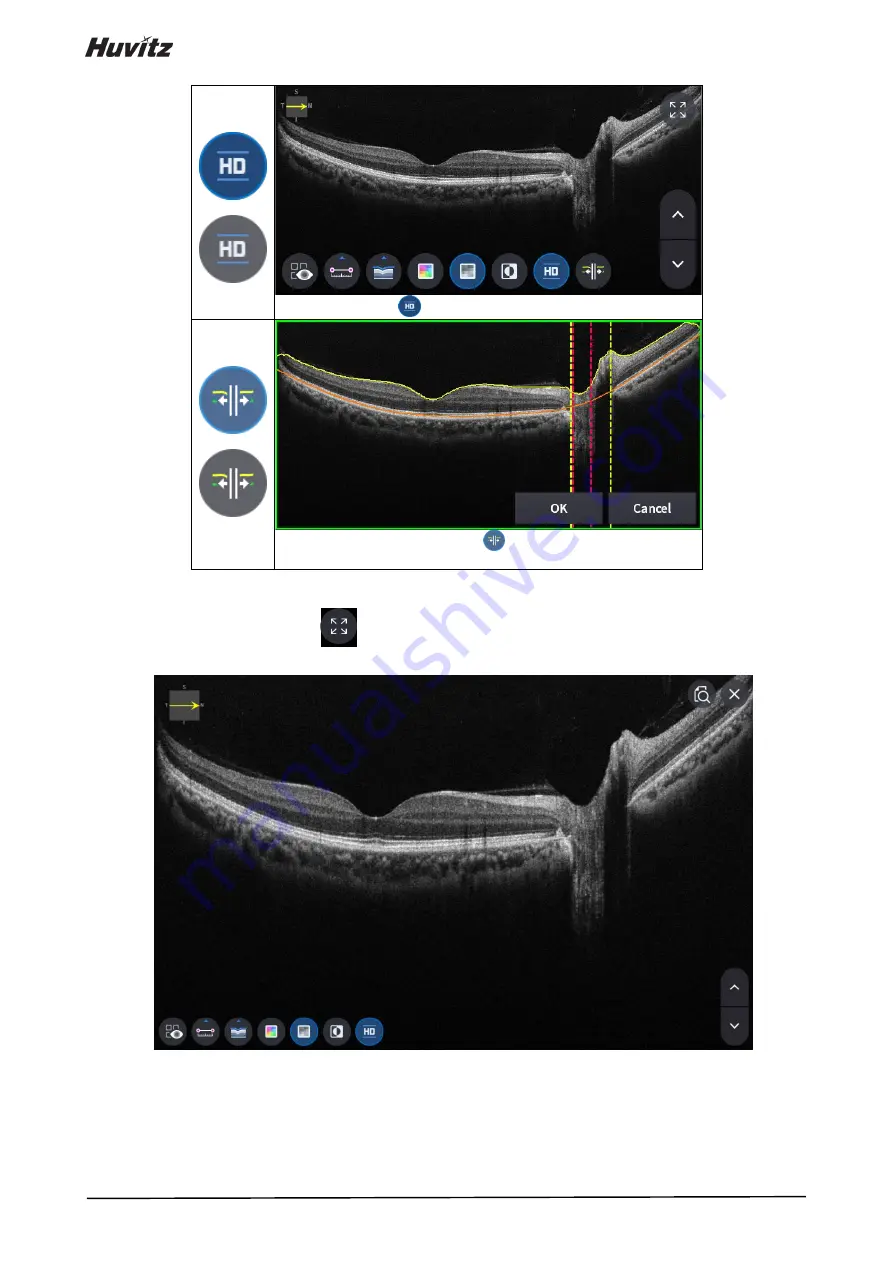 Huvitz HOCT-1 User Manual Download Page 98