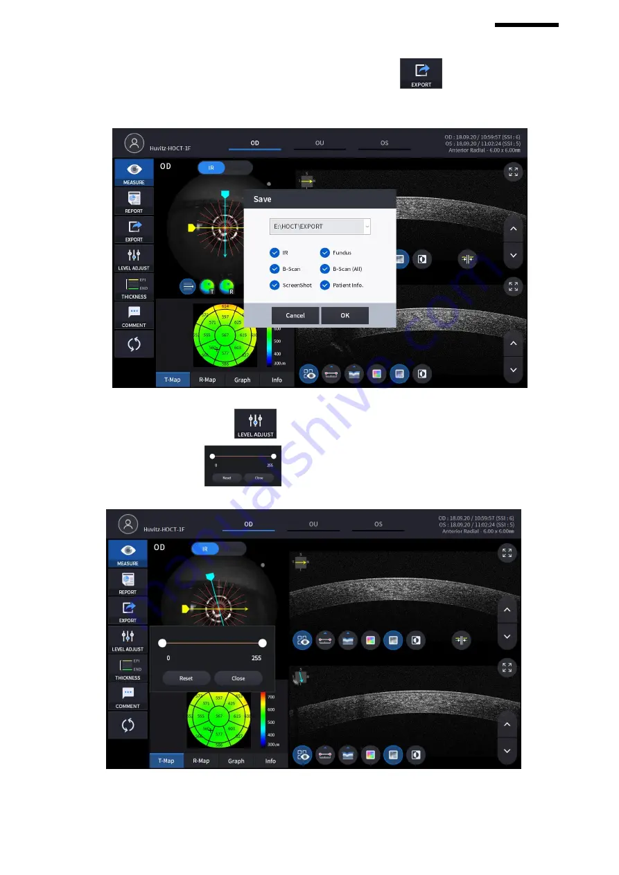 Huvitz HOCT-1 User Manual Download Page 103