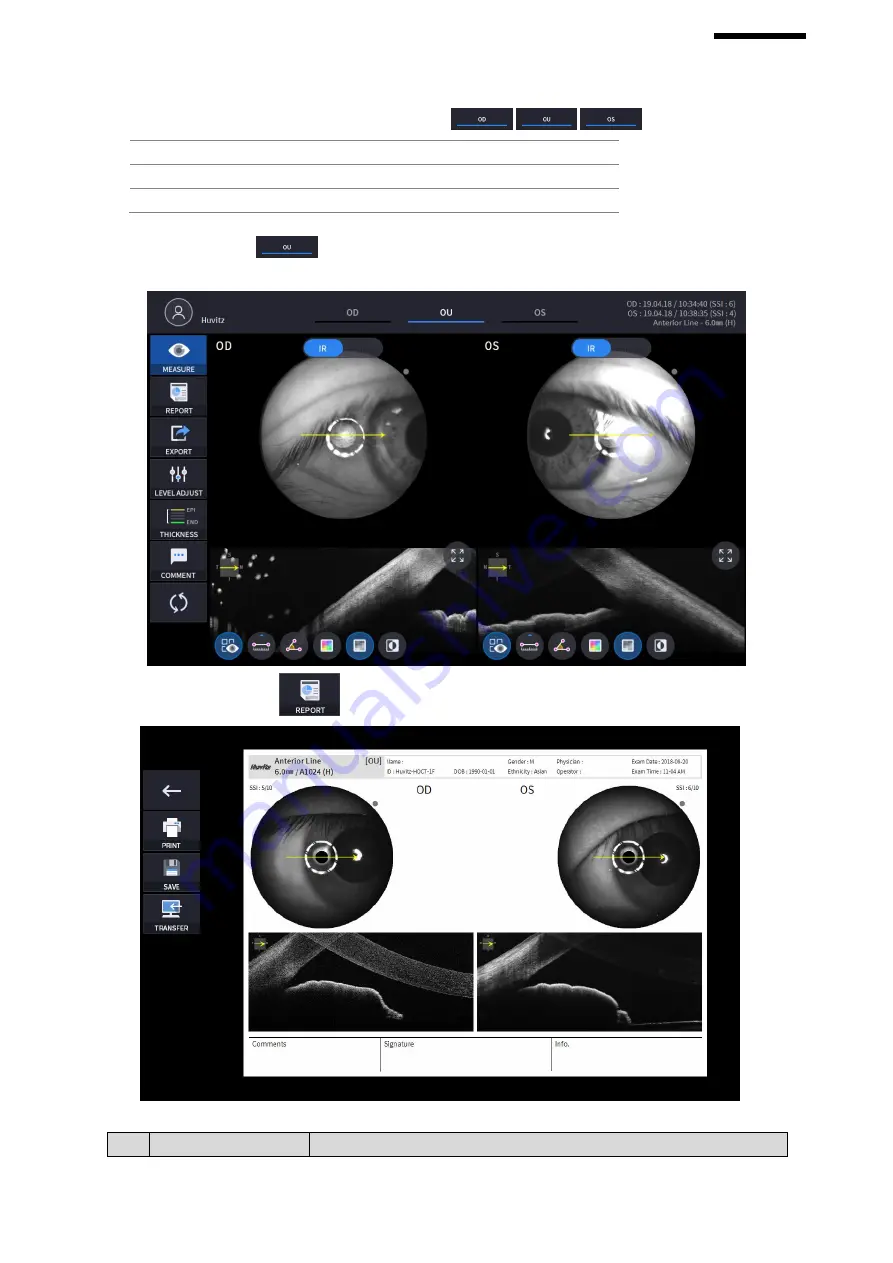 Huvitz HOCT-1 User Manual Download Page 111