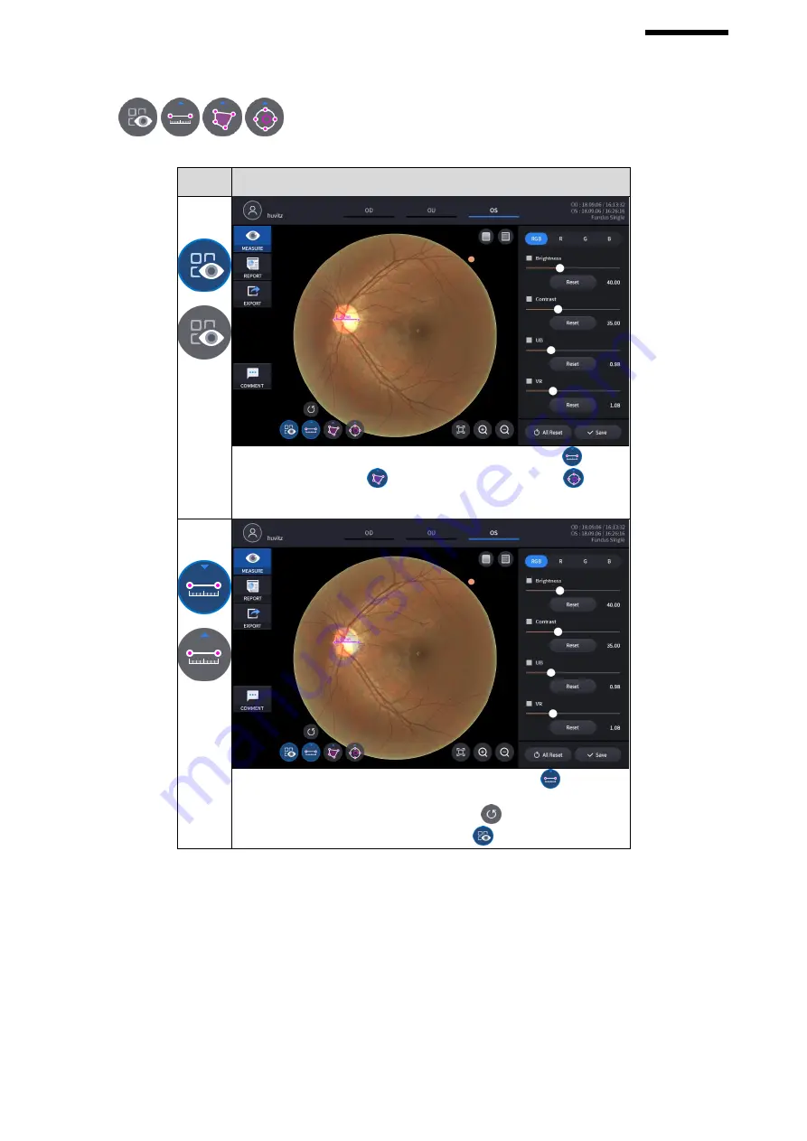 Huvitz HOCT-1 User Manual Download Page 125