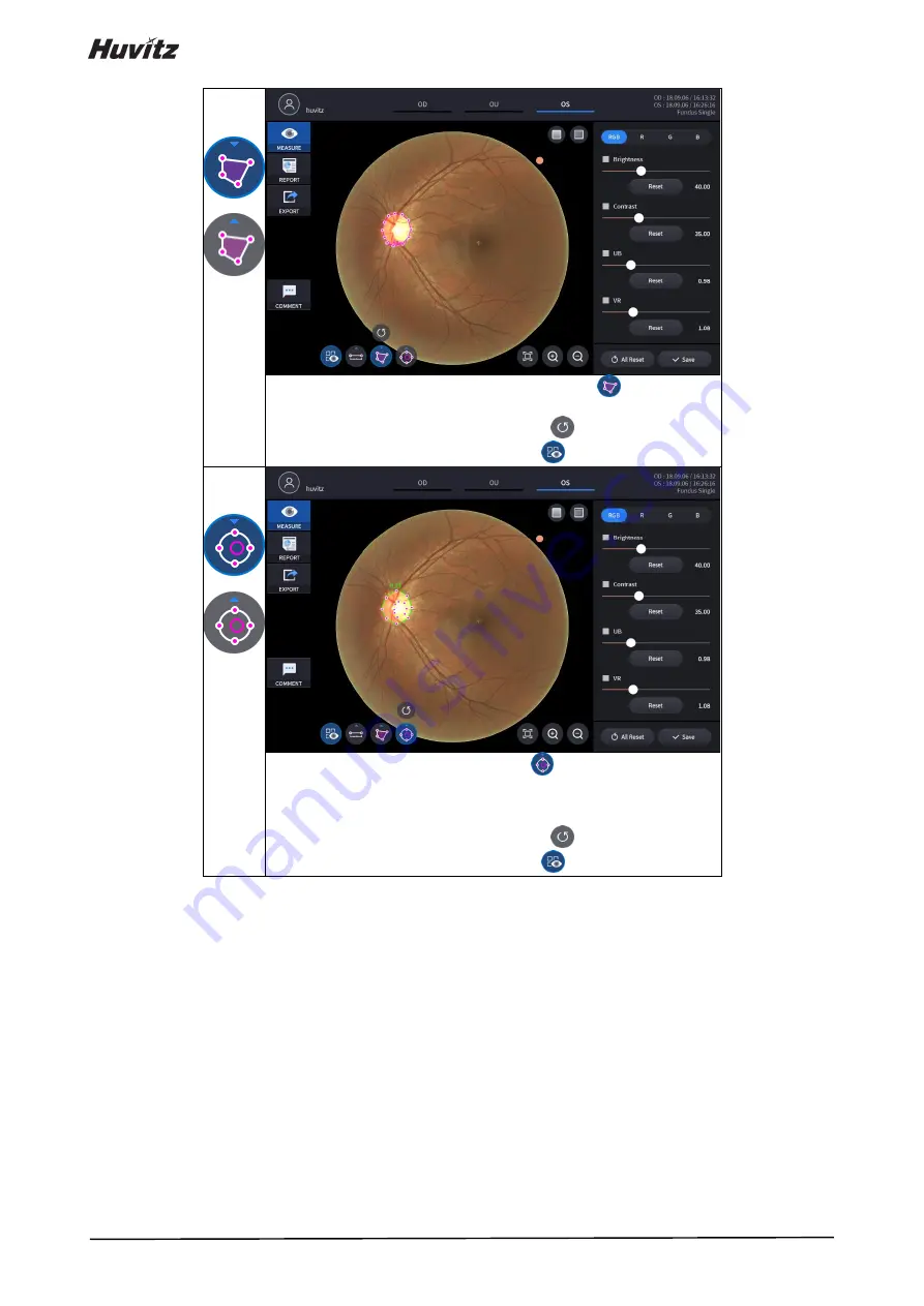 Huvitz HOCT-1 User Manual Download Page 126