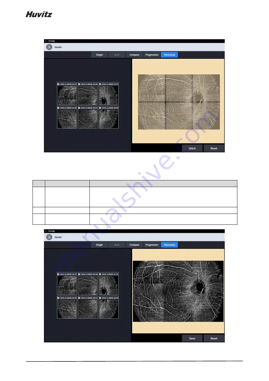 Huvitz HOCT-1 User Manual Download Page 134