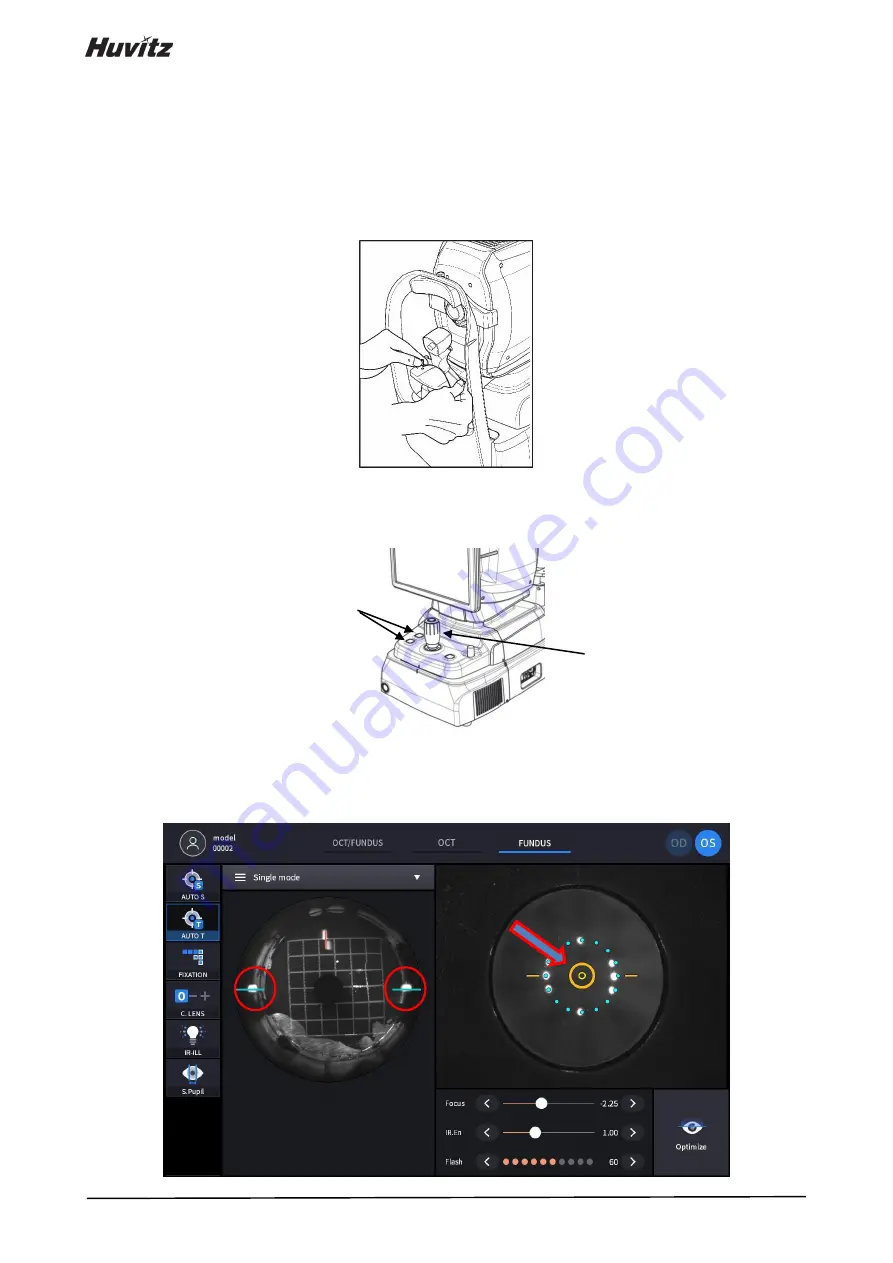 Huvitz HOCT-1 Скачать руководство пользователя страница 142