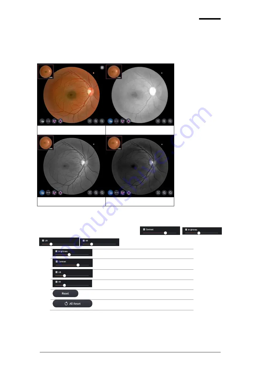 Huvitz HOCT-1F/1 User Manual Download Page 87