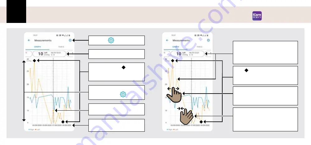 Icare PATIENT2 Quick Manual Download Page 18