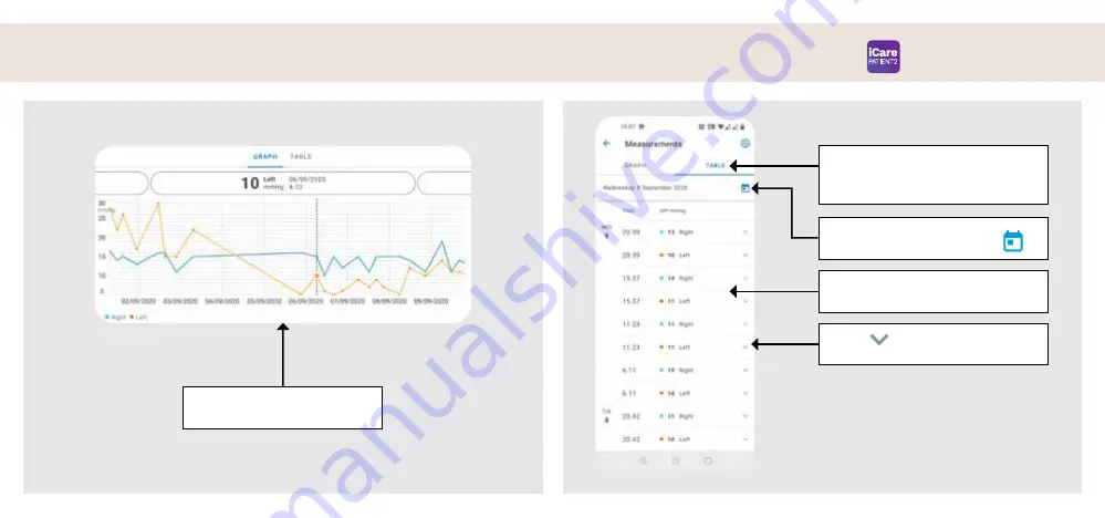 Icare PATIENT2 Quick Manual Download Page 39