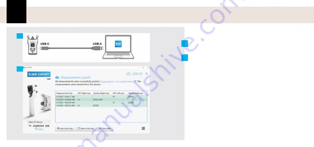 Icare PATIENT2 Quick Manual Download Page 53