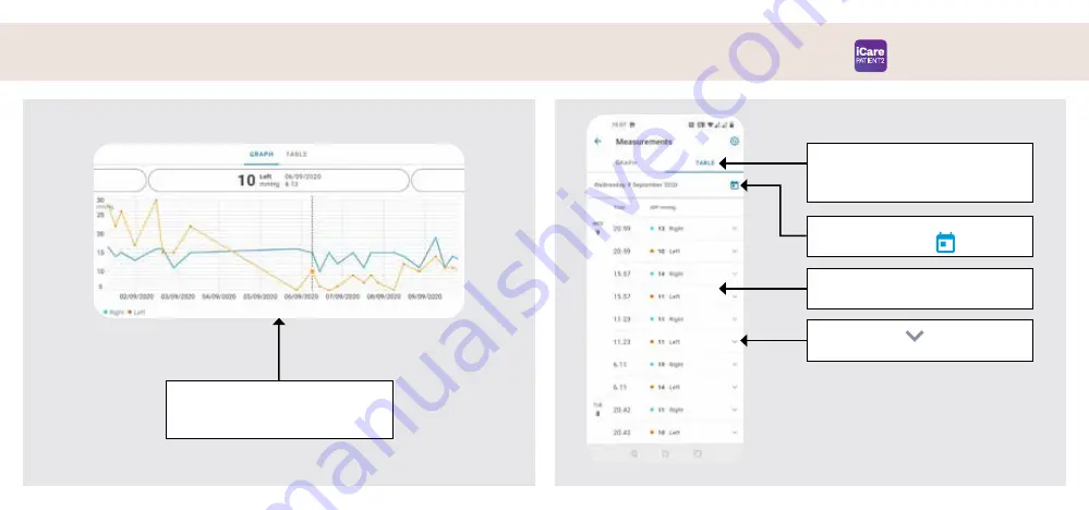 Icare PATIENT2 Quick Manual Download Page 67