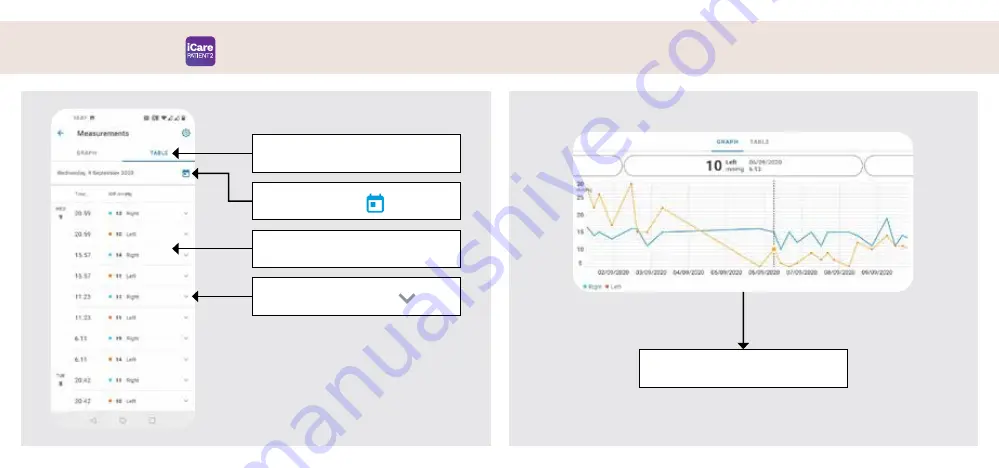 Icare PATIENT2 Quick Manual Download Page 95