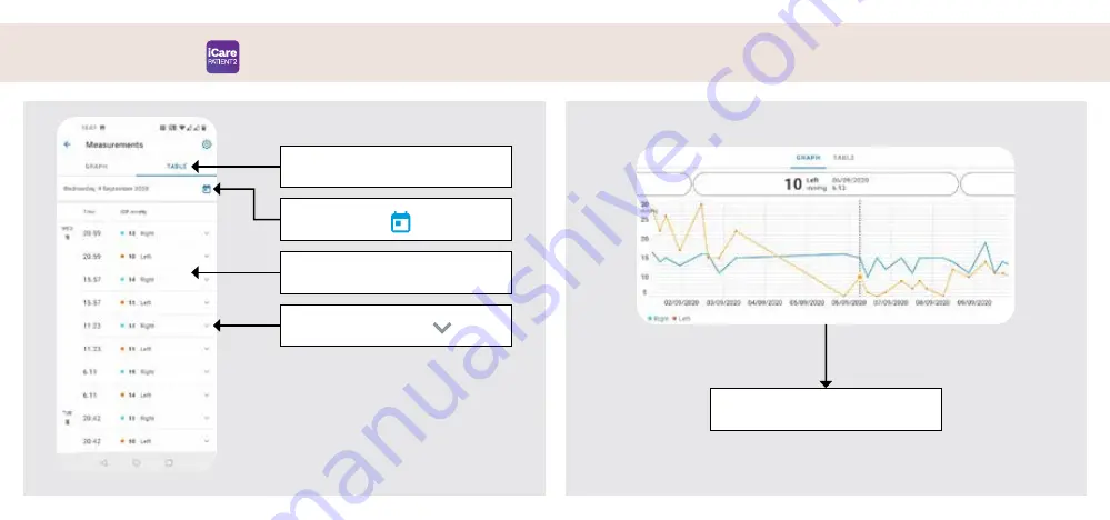 Icare PATIENT2 Quick Manual Download Page 123