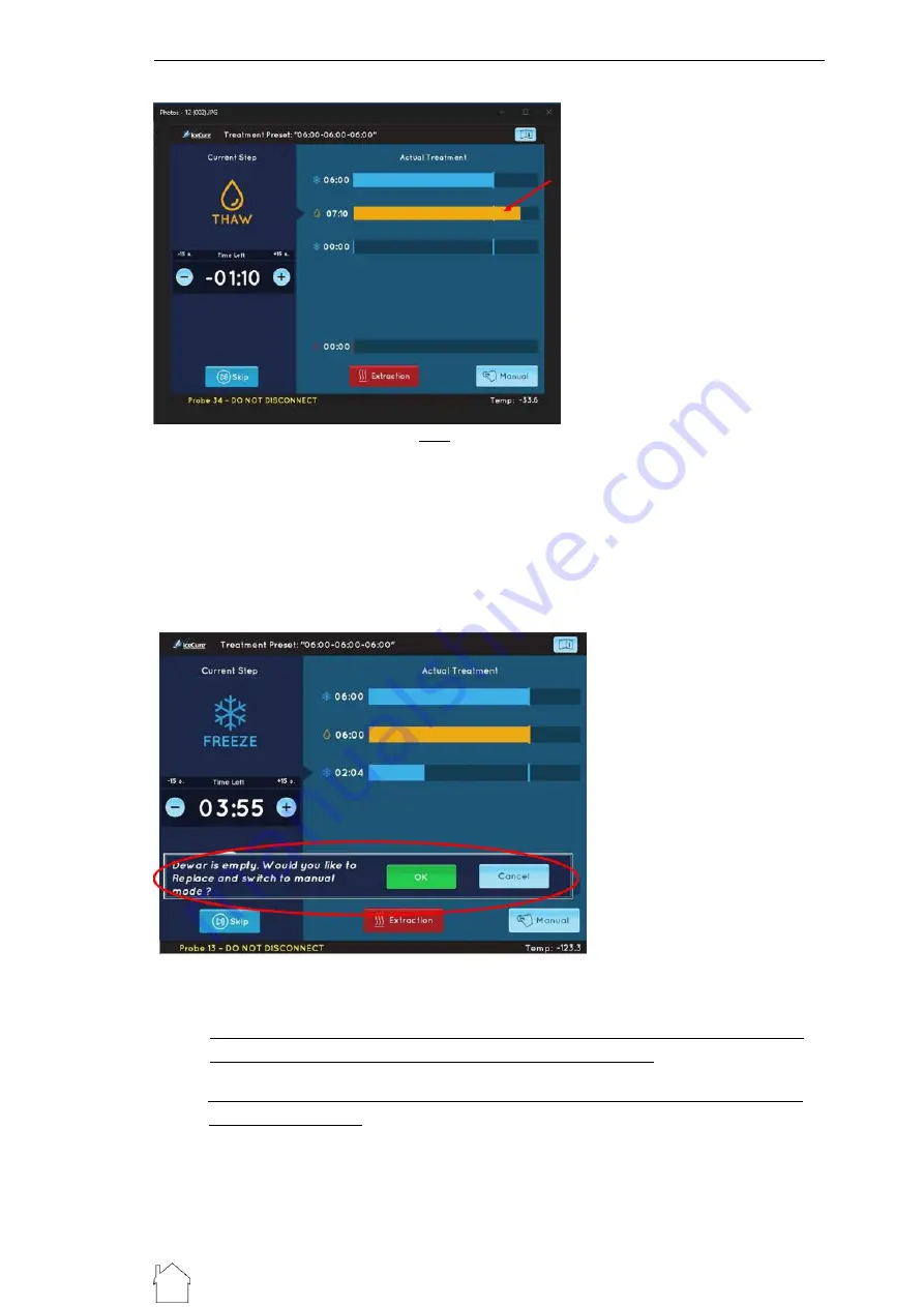 IceCure DSR3200000 User Manual Download Page 105