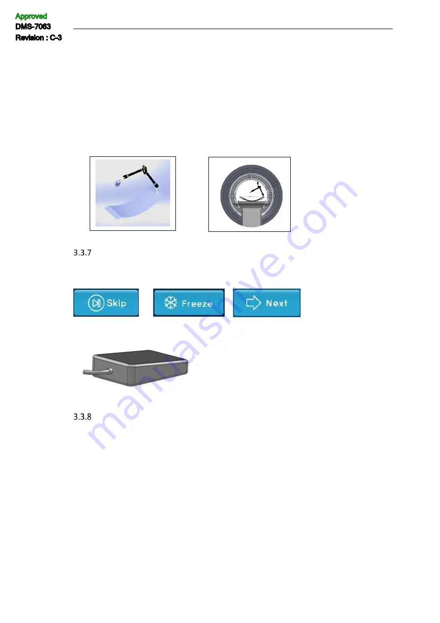 IceCure ProSense DMS-7063 Скачать руководство пользователя страница 47