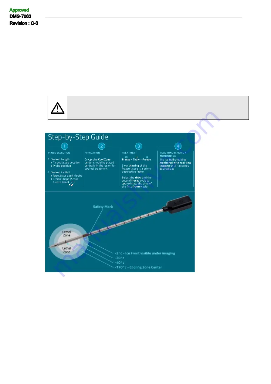 IceCure ProSense DMS-7063 Скачать руководство пользователя страница 68