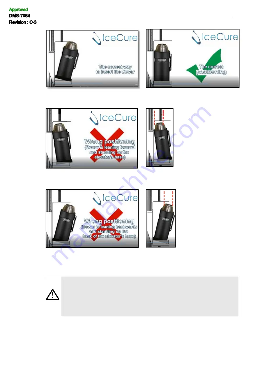 IceCure ProSense FAS3100000 User Manual Download Page 67