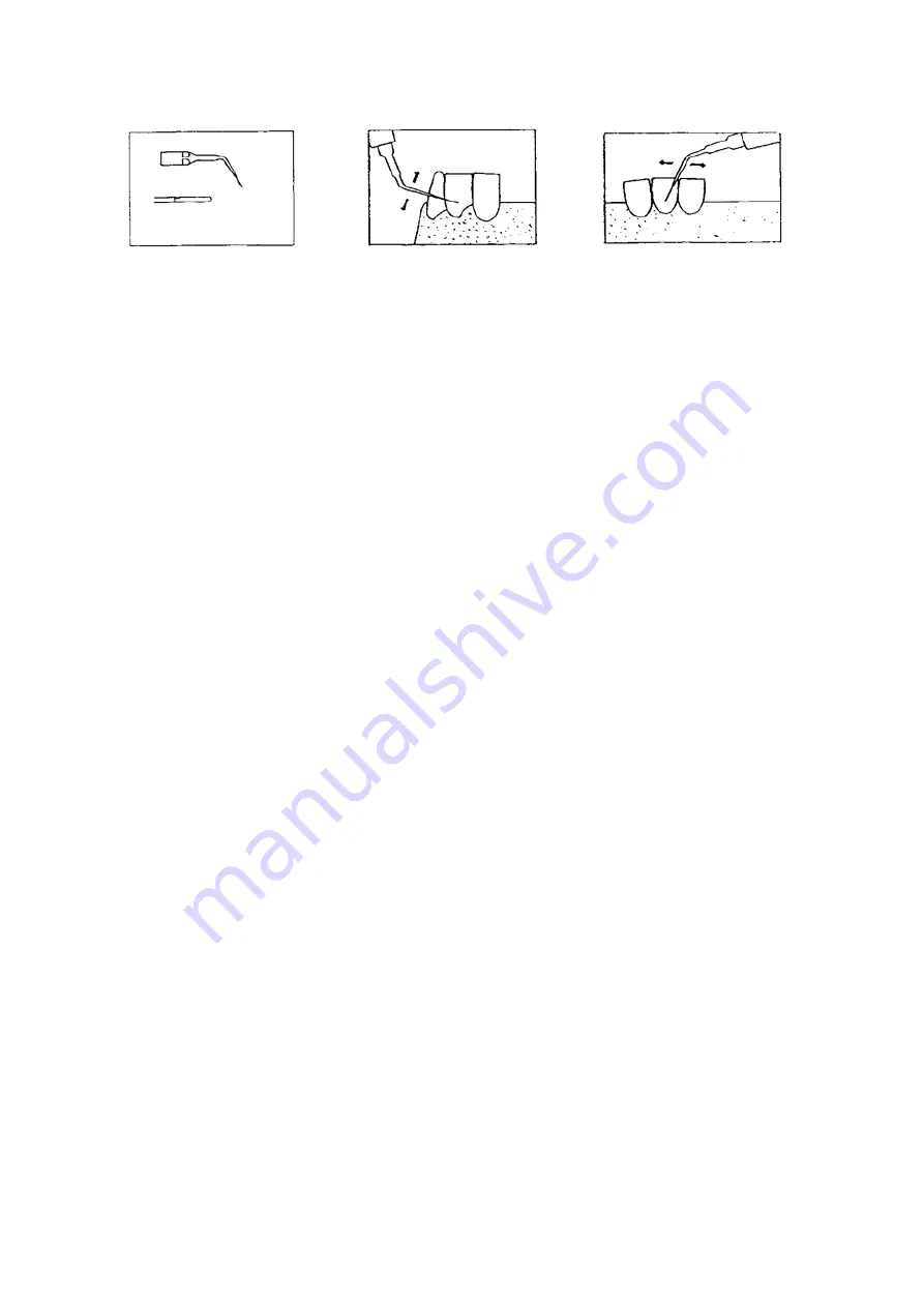 iM3 SP6 Instructions For Use And Technical Description Download Page 54