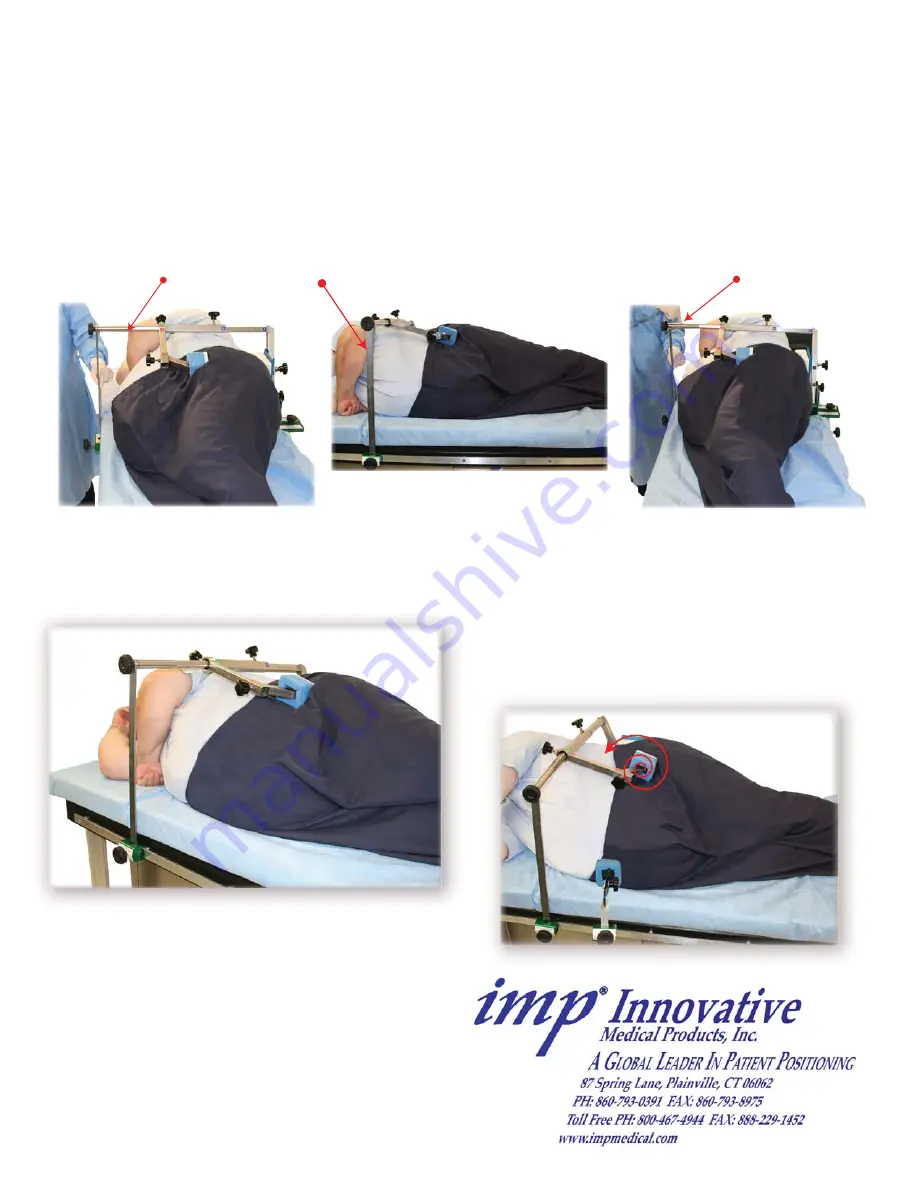 IMP De Mayo Hip Positioner System
OBESE Setup Instructions Download Page 4