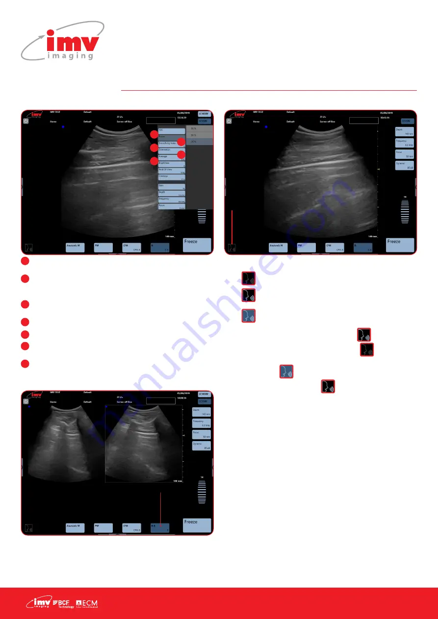 IMV EXAPad Instruction Manual Download Page 10