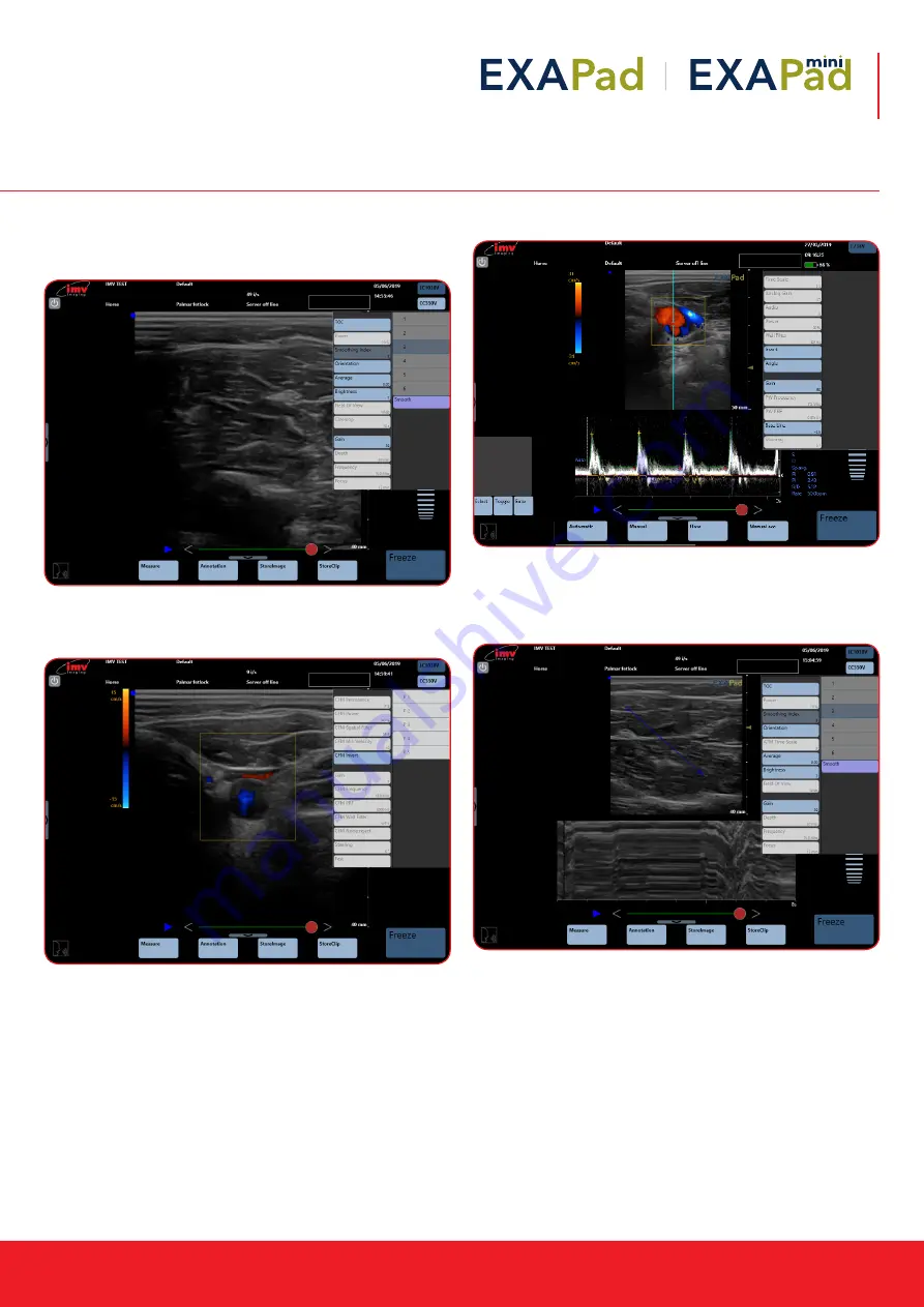 IMV EXAPad Instruction Manual Download Page 17