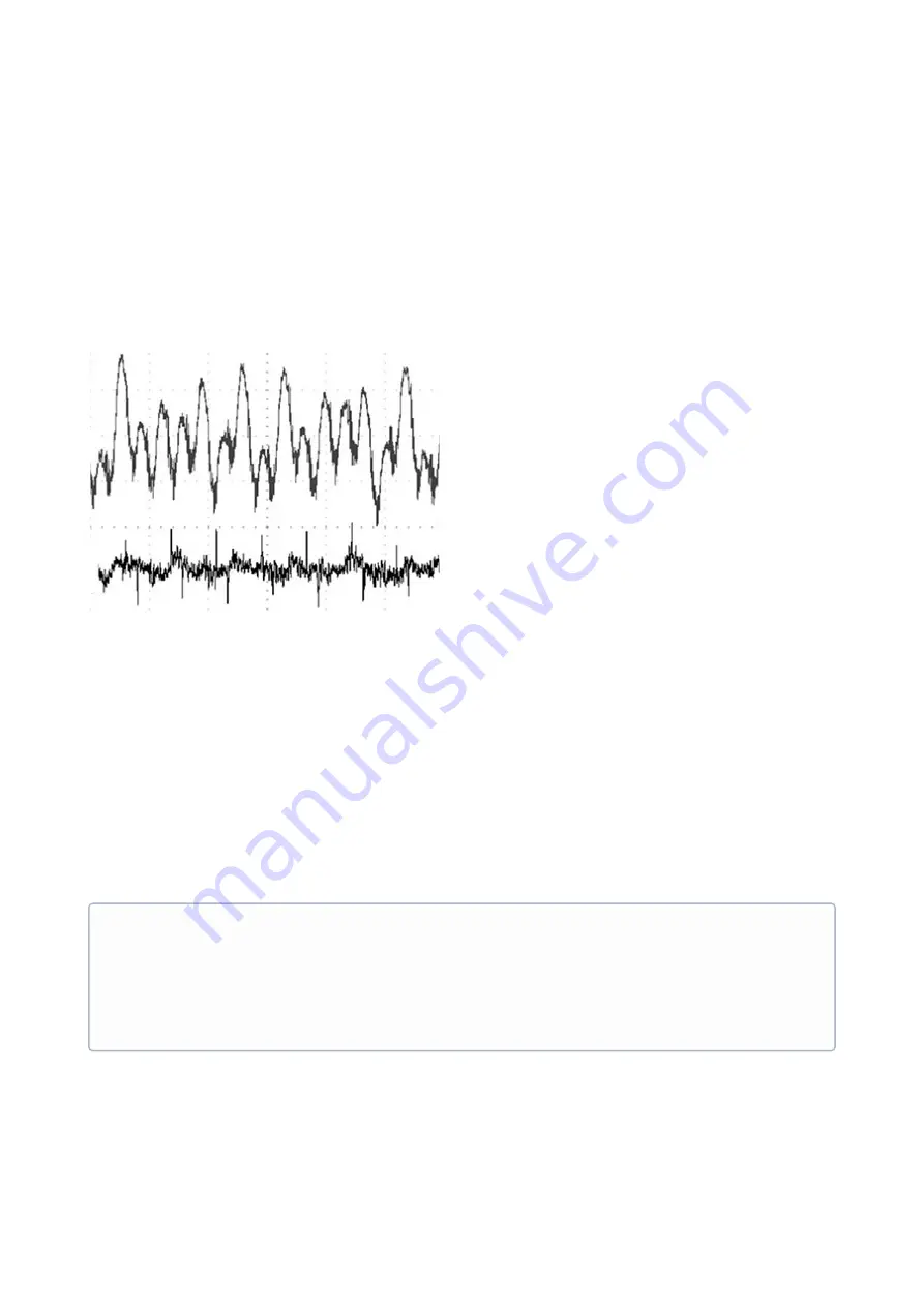 INGENIA Everest CORE Product Manual Download Page 25