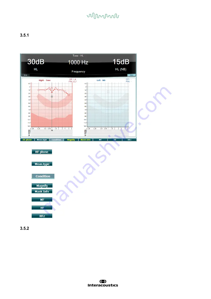 Interacoustics AD629 Instructions For Use Manual Download Page 18