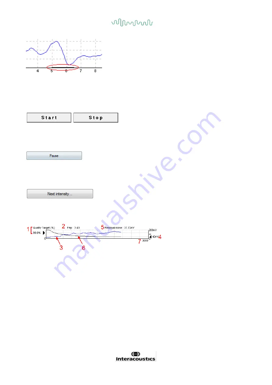 Interacoustics Eclipse ABRIS Скачать руководство пользователя страница 33