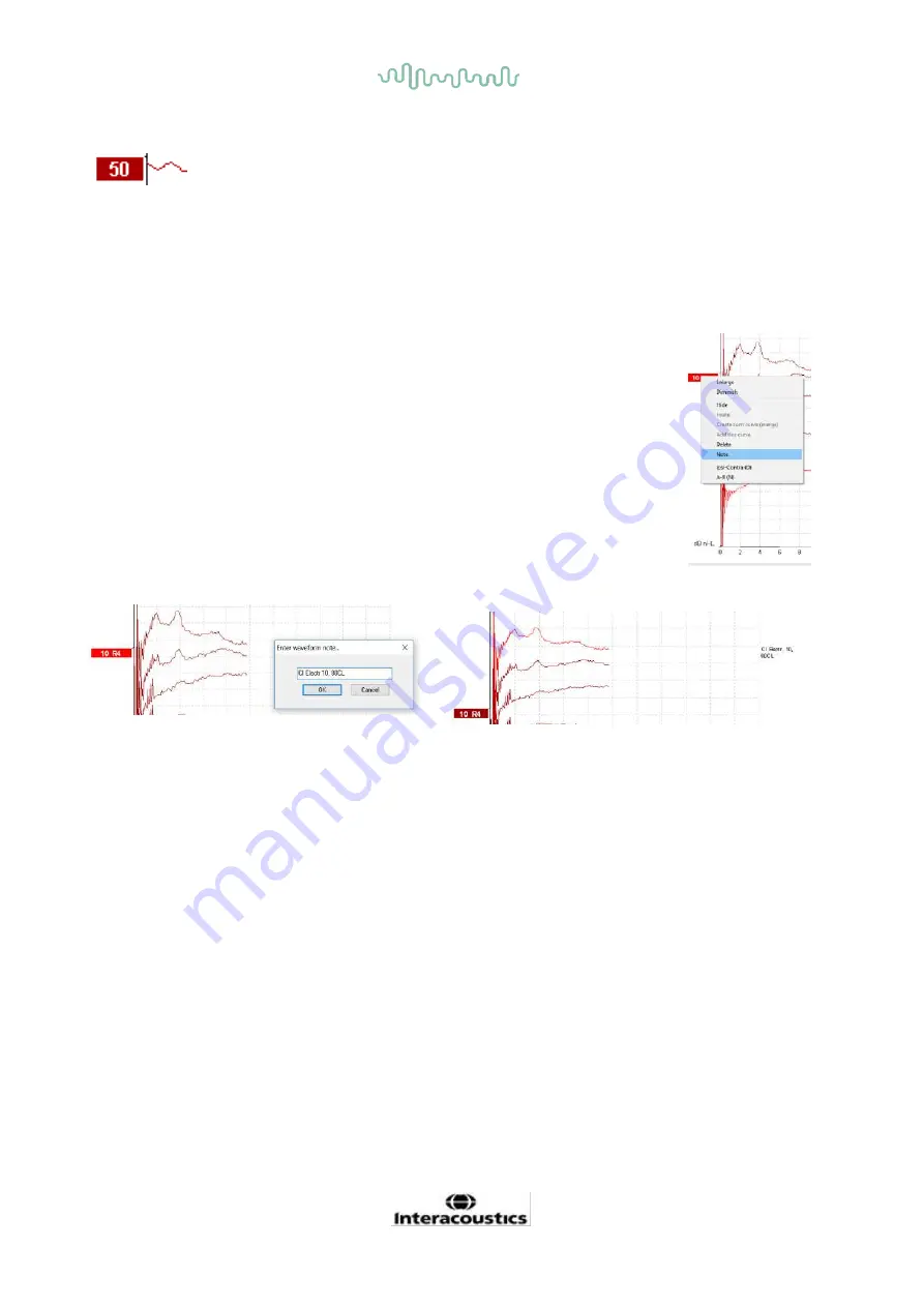 Interacoustics Eclipse ABRIS Скачать руководство пользователя страница 37