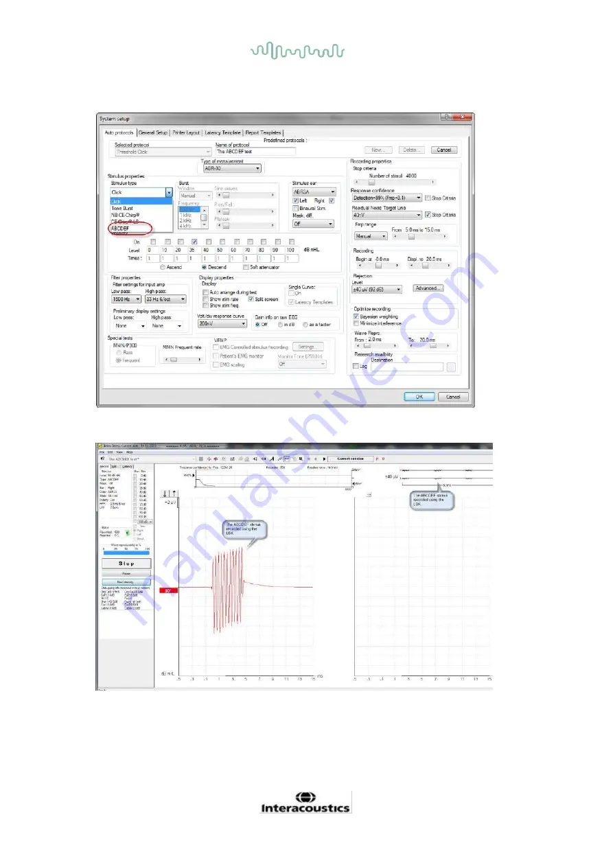 Interacoustics Eclipse ABRIS Instructions For Use Manual Download Page 79