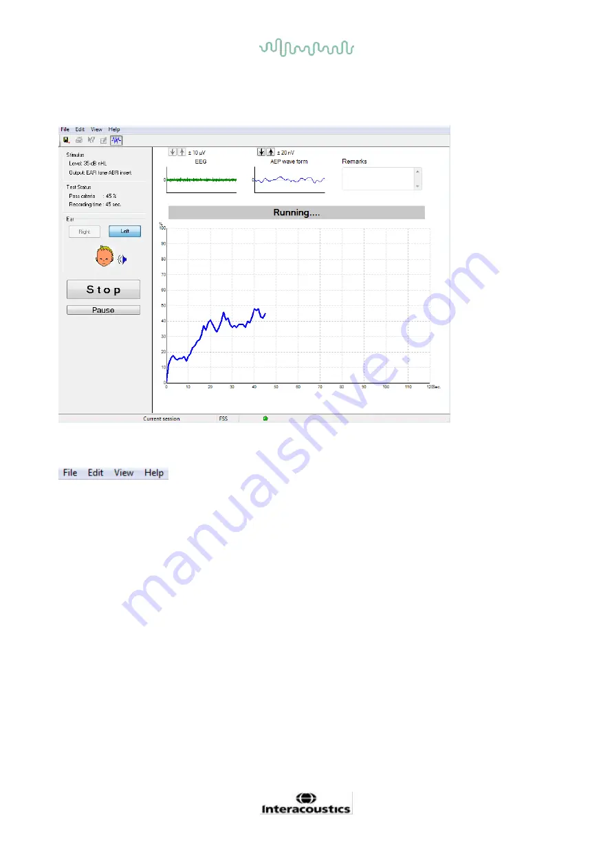 Interacoustics Eclipse ABRIS Instructions For Use Manual Download Page 107