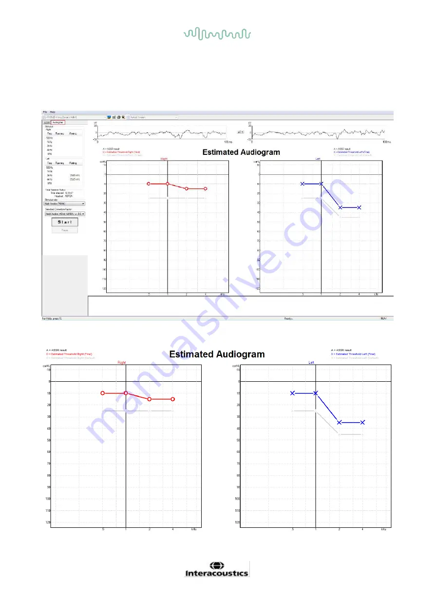 Interacoustics Eclipse ABRIS Instructions For Use Manual Download Page 124