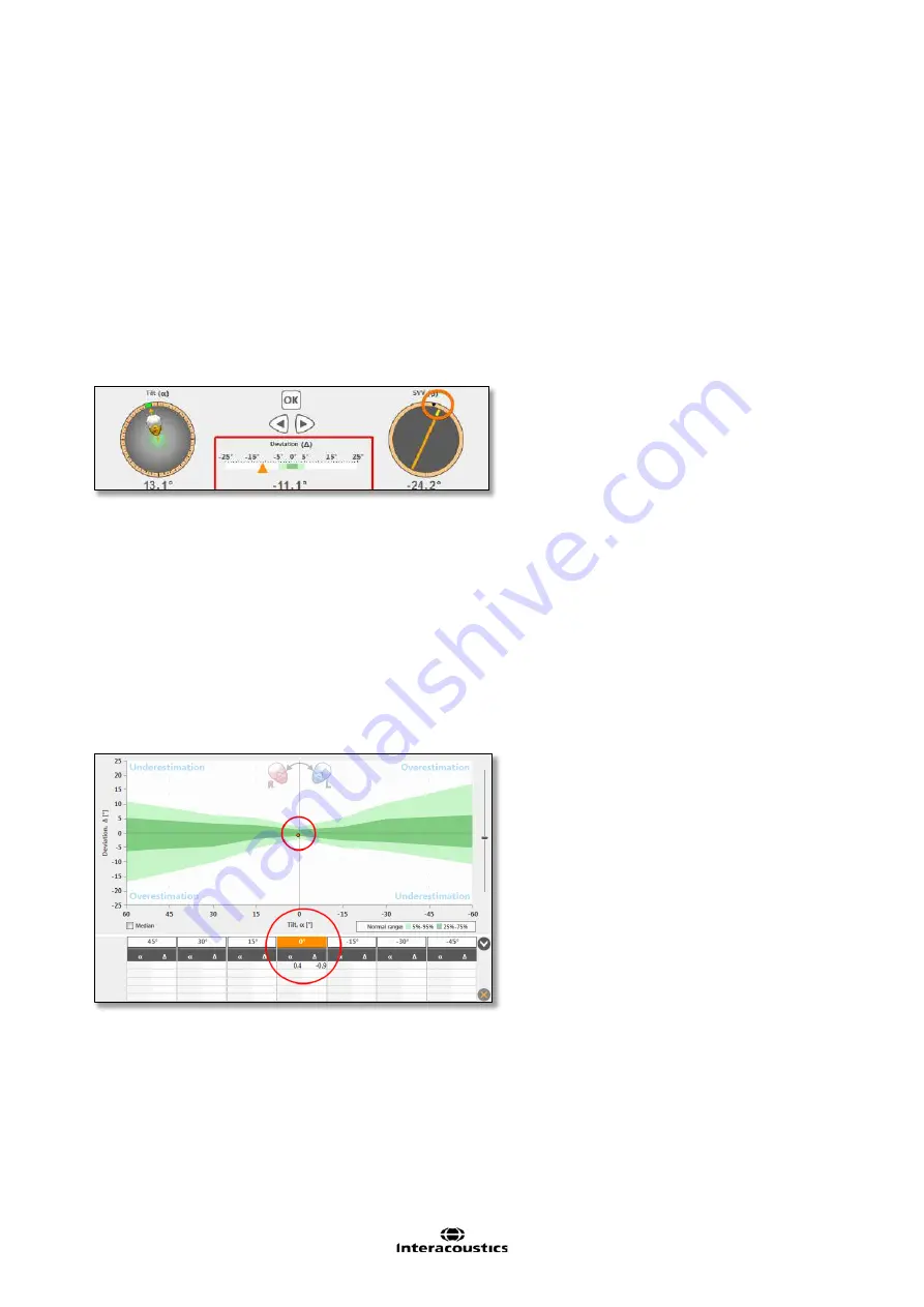 Interacoustics Virtual SVV Instructions For Use Manual Download Page 32